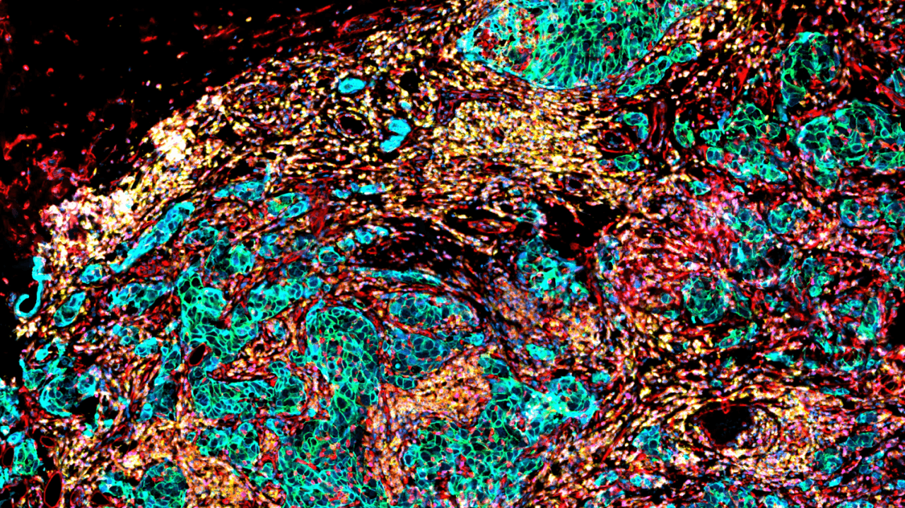 Immunology and Immune Disorders